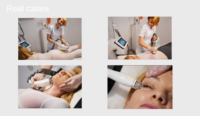 Cavitation+Vacuum+RF+Laser+Roller-System, das Schönheits-Ausrüstung CER abnimmt