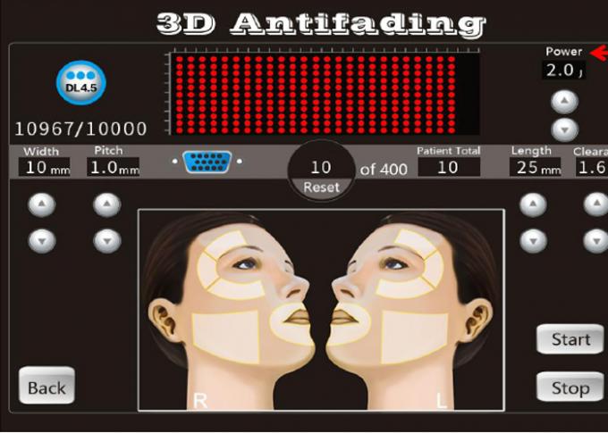 20000 der Schuss-3D Hifu Patronen Verschönerungs-der Maschinen-8 mit 1-11 zeichnet