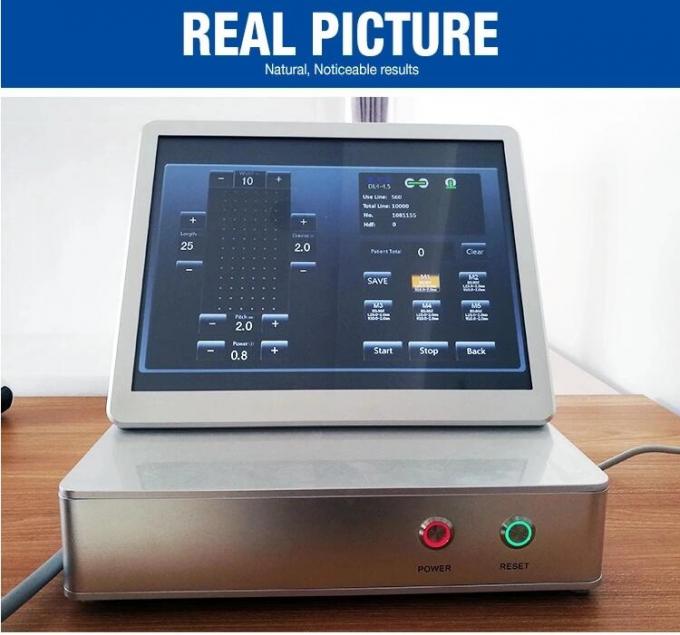4MHz 11 Linien tragbare Hifu-Maschine/20000 Schüsse 2D Hifu-Verschönerungs-Behandlung