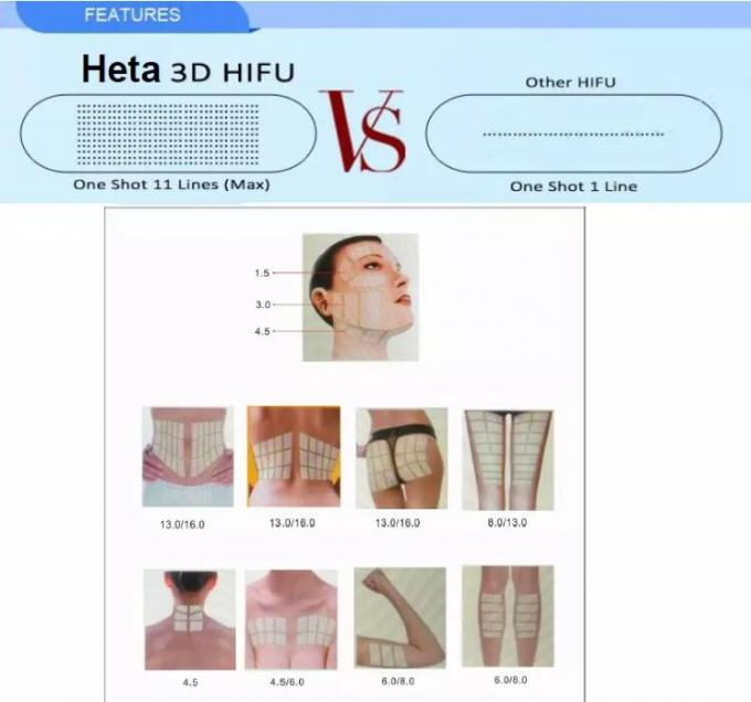 Haut 150VA Hifu, die Patronen der Maschinen-8/Hifu abnimmt Maschinen15-zoll-bildschirm festzieht