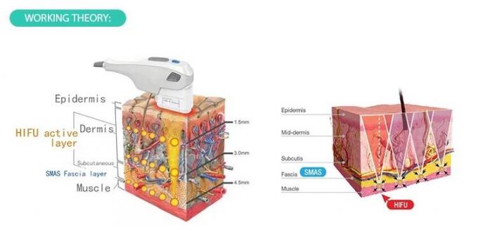 Ultraschall-tragbare Hifu-Schönheits-Maschinen-Intensitäts-fokussierte CER-Zustimmung 50-60Hz