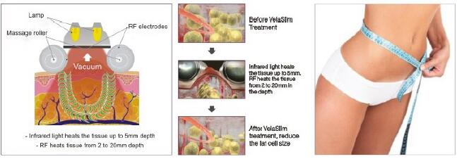 Vakuum-Rf der Hohlraumbildungs-40K, der Maschine V9 Velashape mit CER Bescheinigung abnimmt