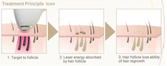 Dauerhafte IPL Laser-Maschinen-aktives TECHNISCHES Abkühlen mit Deutschland-Laser-Stangen